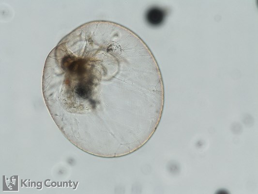 Photo of Noctiluca scintillans